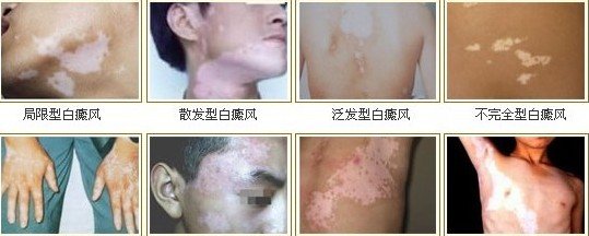 点击咨询在线专家 16.jpg